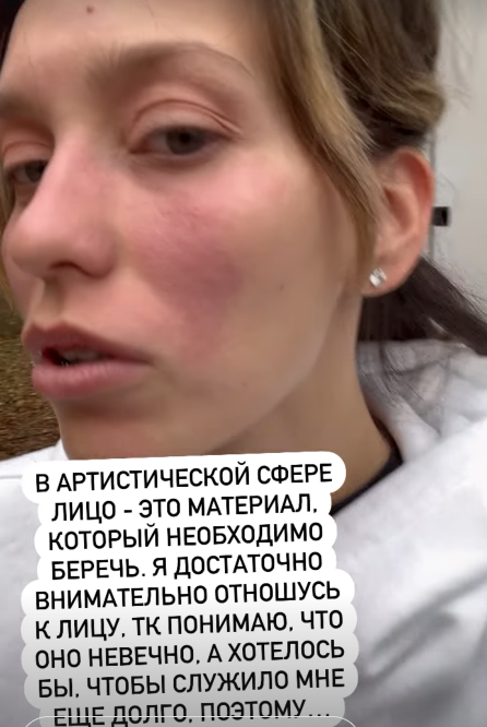 Регина Тодоренко перенесла приступ аллергии на съемках сериала